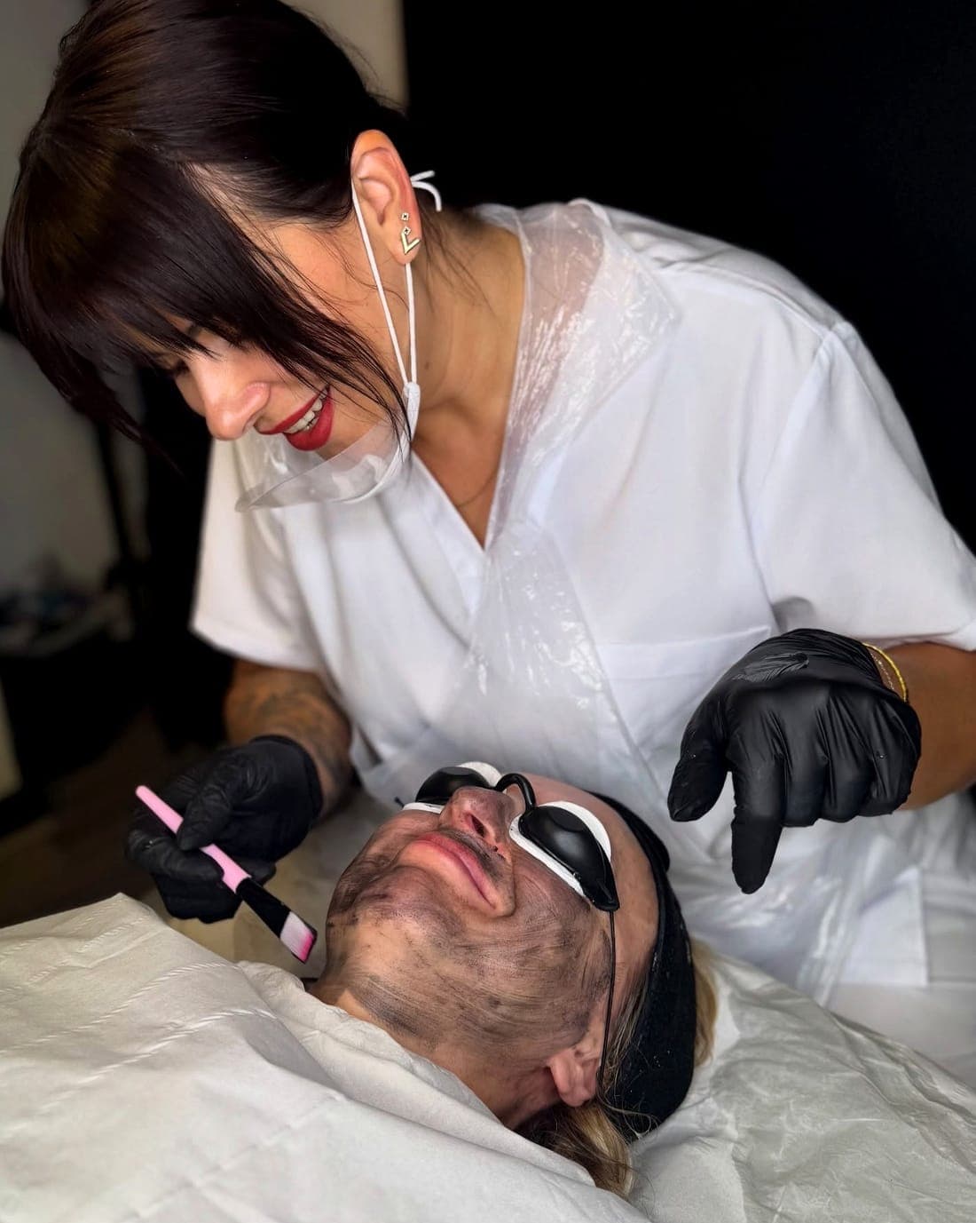 Carbon Facial — example 1