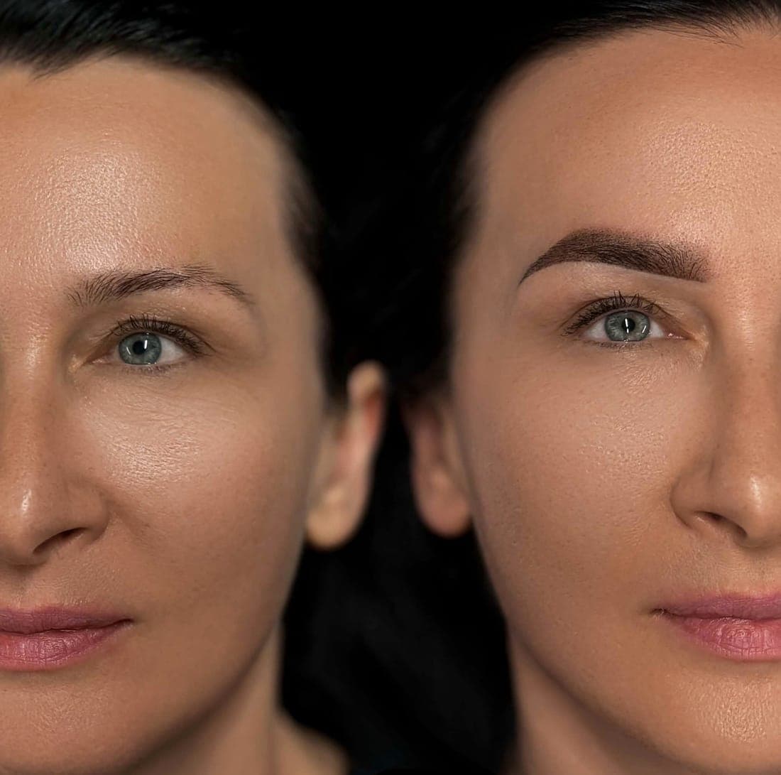 Semi-Permanent Brows — example 7